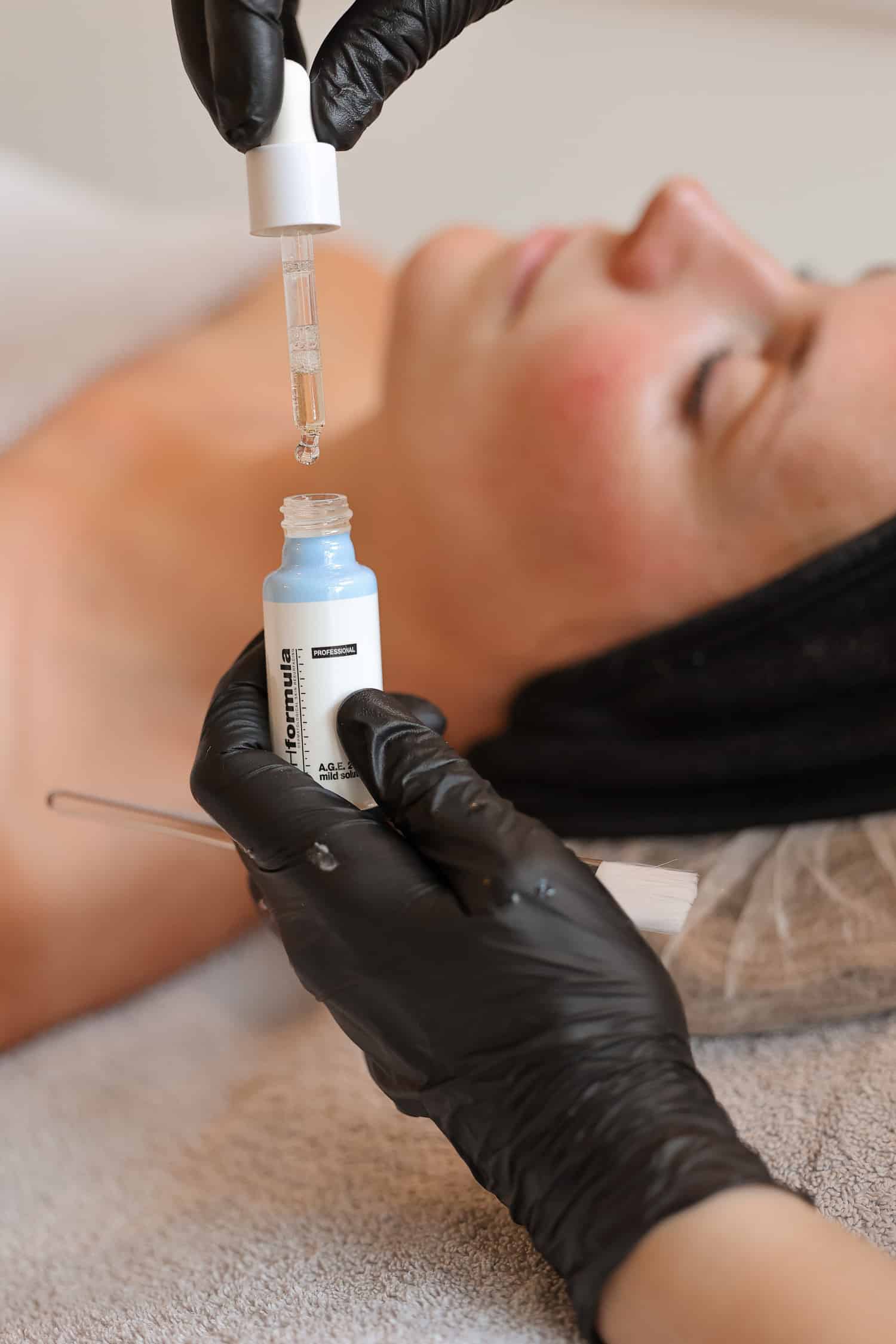 Huidverjonging behandeling